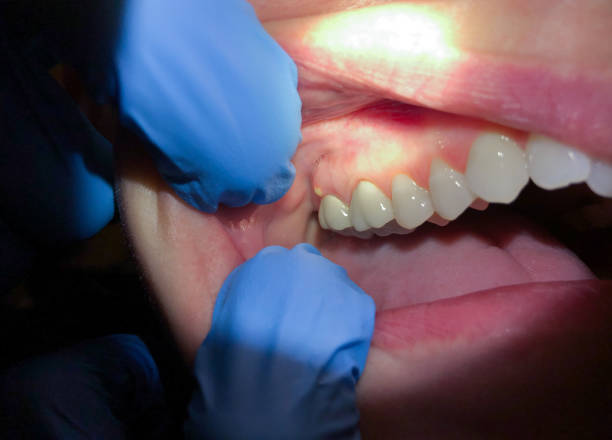 Best Weekend Emergency Dentist in Gainesboro, TN